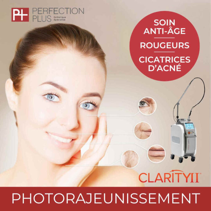 photorajeunissement-clarity-II-opt
