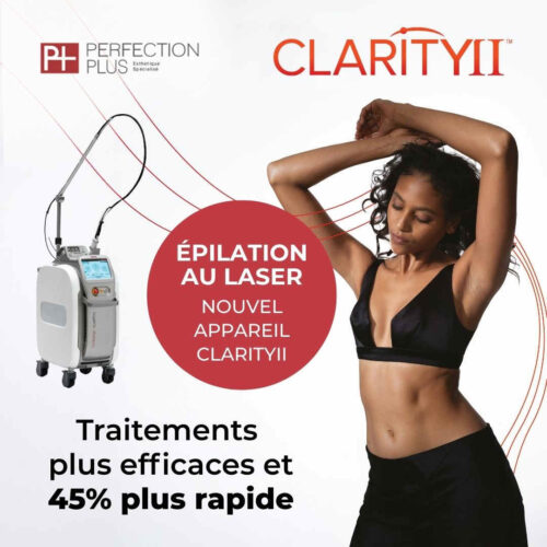 Épilation Laser Clarity II